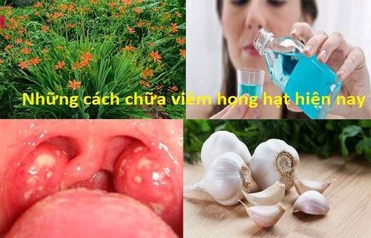 Cách chữa viêm họng hạt