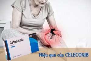 Celecoxib có hiệu quả nhanh nhưng có nhiều tác dụng phụ