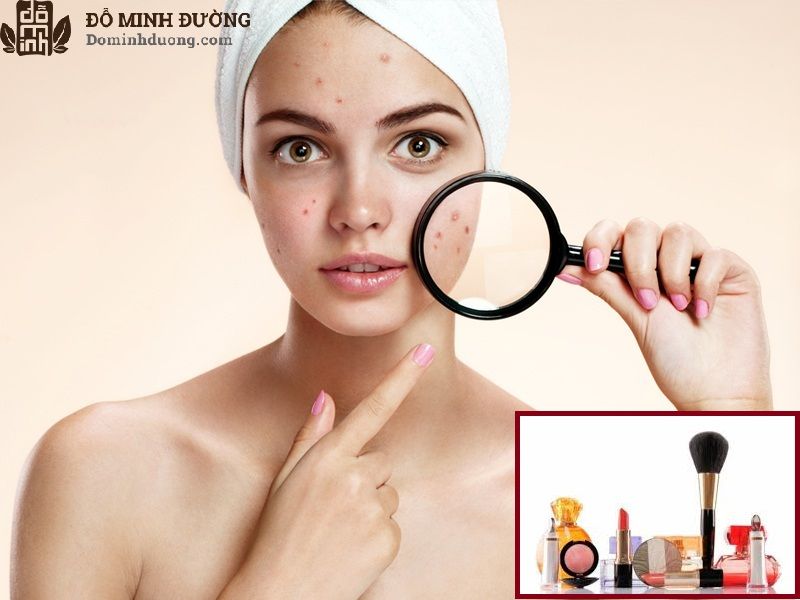 Sử dụng mỹ phẩm không phù hợp hoặc chất lượng kém dễ gây dị ứng da mặt 