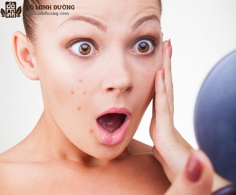 Đắp mặt nạ lòng trắng trứng có thể gây kích ứng nổi mụn trên da 
