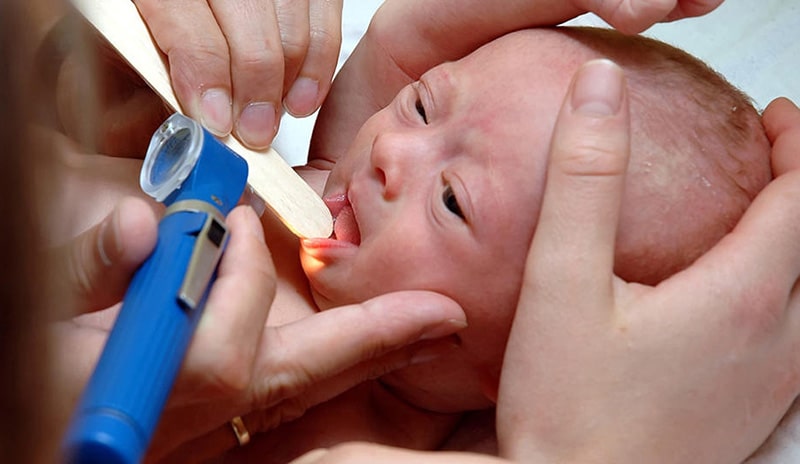 Trẻ sơ sinh bị viêm mũi họng cấp vô cùng nguy hiểm nếu không được phát hiện sớm