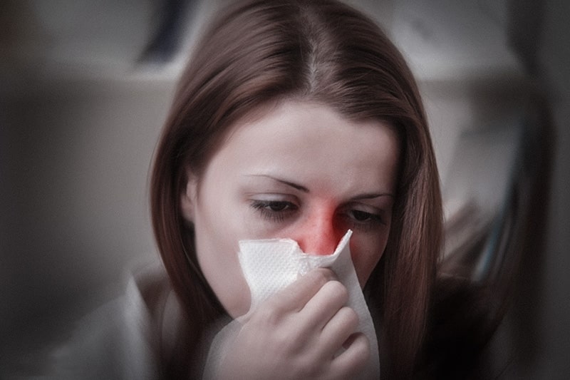 Nhận biết viêm xoang viêm mũi dị ứng sớm để điều trị kịp thời