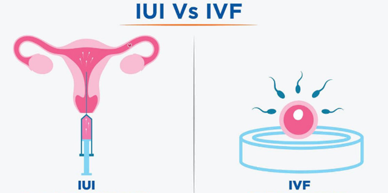 IUI và IVF là 2 phương pháp hỗ trợ sinh sản hoàn toàn khác nhau, có ưu và nhược điểm riêng