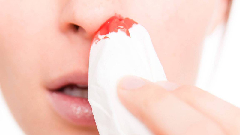 Xì mũi ra máu có thể là do tác động bên ngoài hoặc do một số bệnh lý nào đó