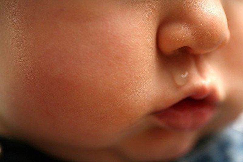 Sổ mũi ở trẻ sơ sinh là bị gây ra bởi nhiều nguyên nhân