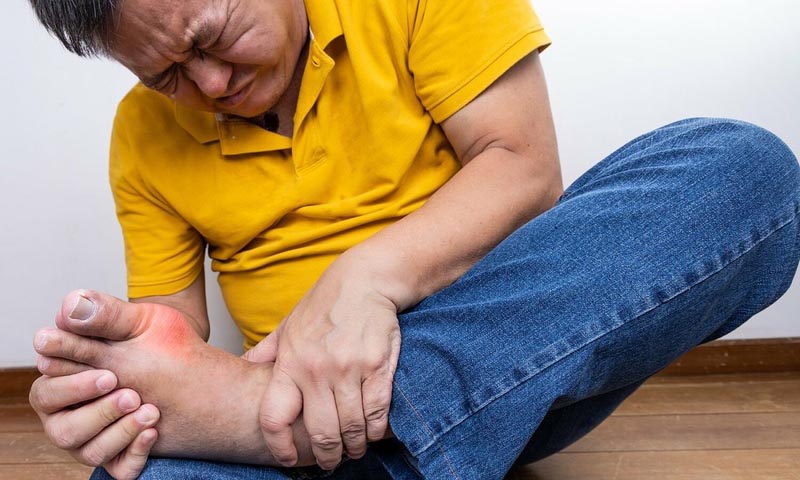 Gout là bệnh viêm khớp phổ biến, xuất hiện khi lượng acid uric tăng cao quá mức