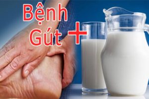 Bệnh Gout Uống Sữa Gì? 5 Sản Phẩm Bác Sĩ Khuyên Dùng