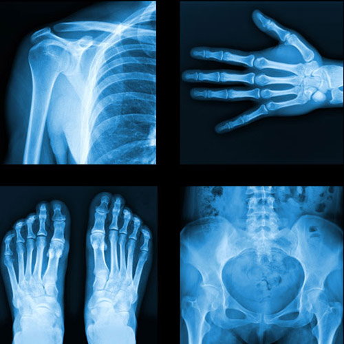 X-quang thường quy để phát hiện các dấu hiệu bất thường