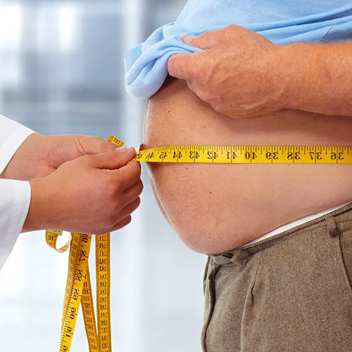 Thừa cân béo phì dễ gây thoái hóa khớp háng