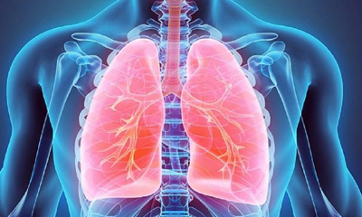 3 Cách Chữa Viêm Phế Quản Người Bệnh Nên Tham Khảo